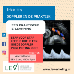 Doppler in de praktijk – meten PI en RI van de arteria umbilicalis en arteria cerebralis media